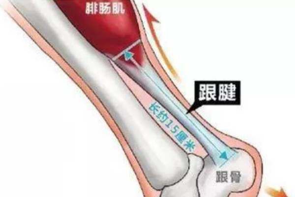 跟组词,跟组词有哪些图1