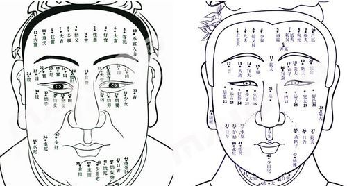 脸上长痣面相图,脸上长痣面相图 不能点的痣怎么办图4
