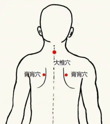 病入膏肓的意思,病入膏肓的意思图2