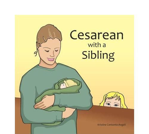 cesarean,cesarean section是什么意思图1