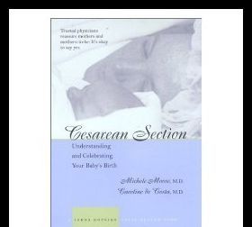 cesarean,cesarean section是什么意思图3